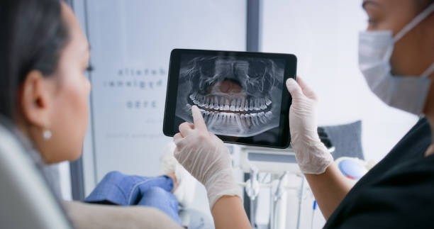 Licensed Wisdom Tooth Removal service in Paloma Creek South, TX - Smile Center Dentistry